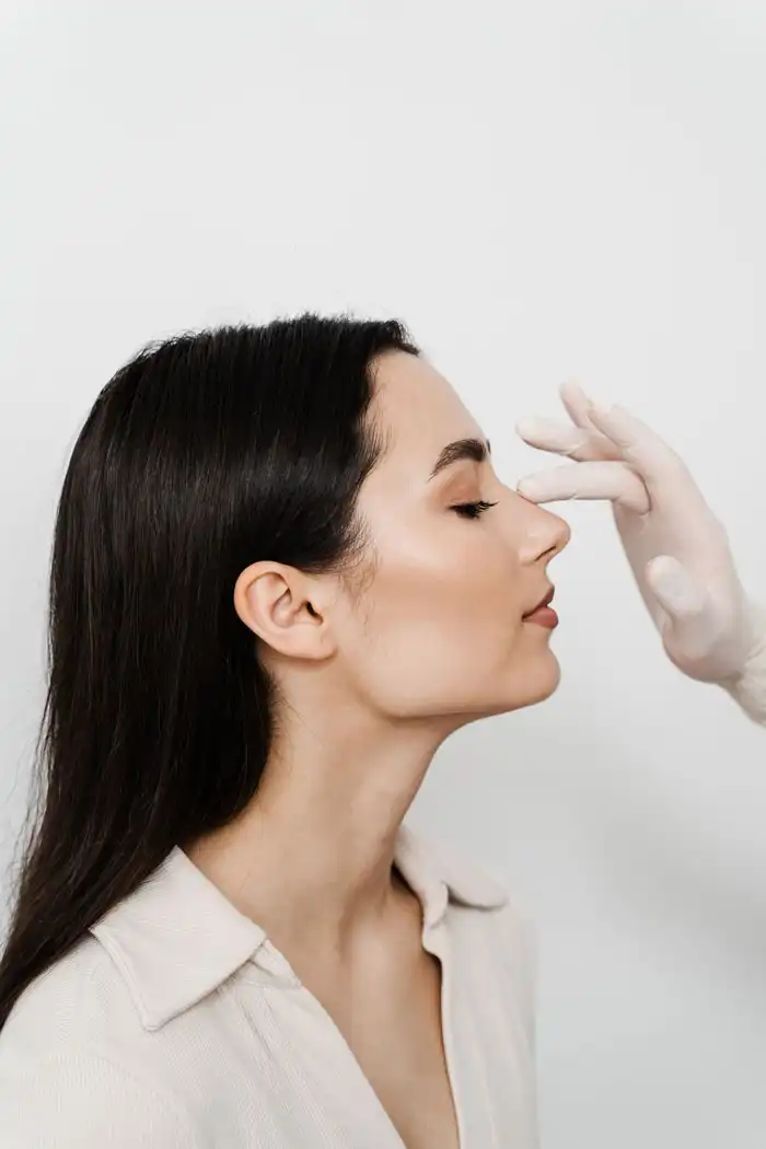 rhinoplasty