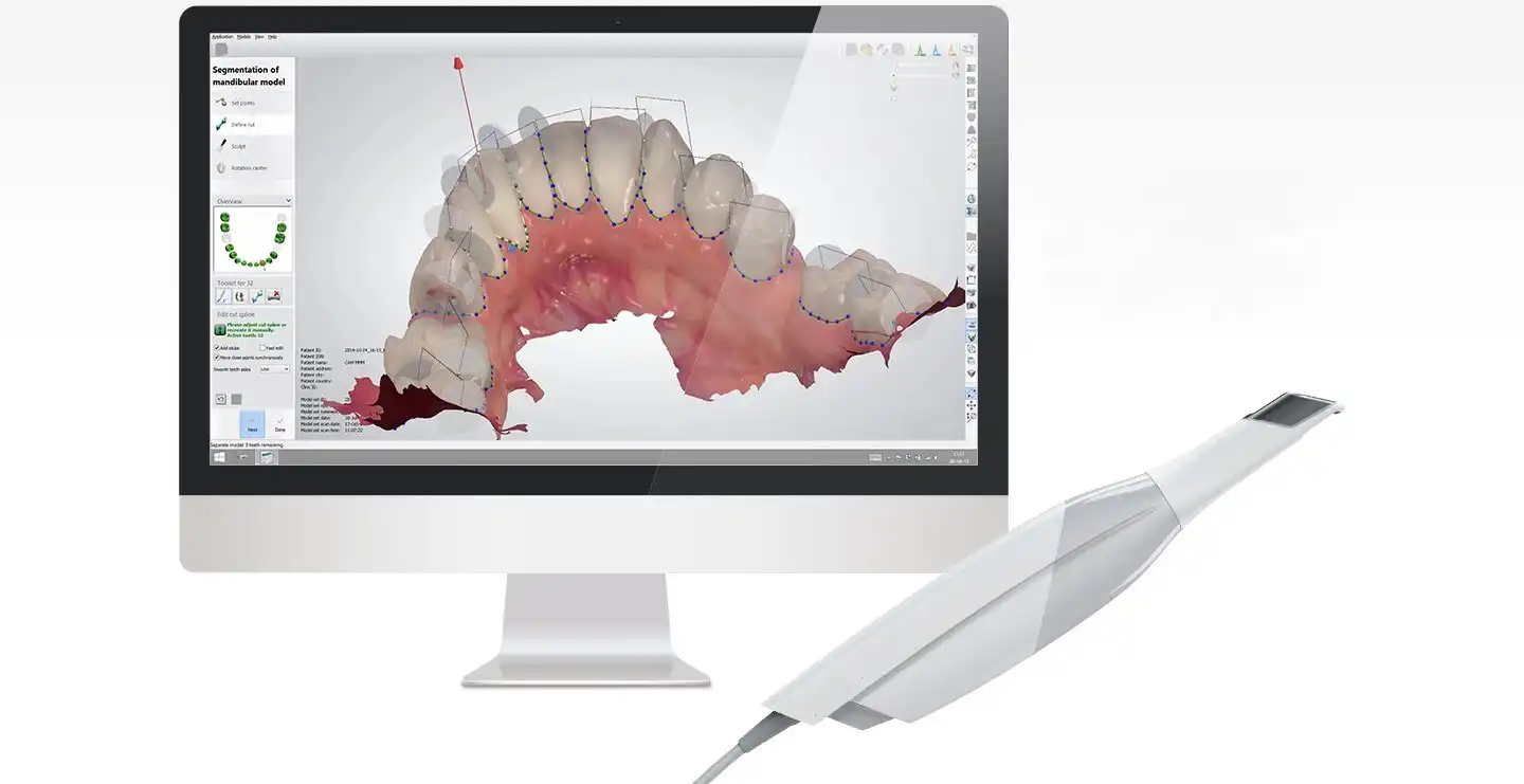 digital smile design