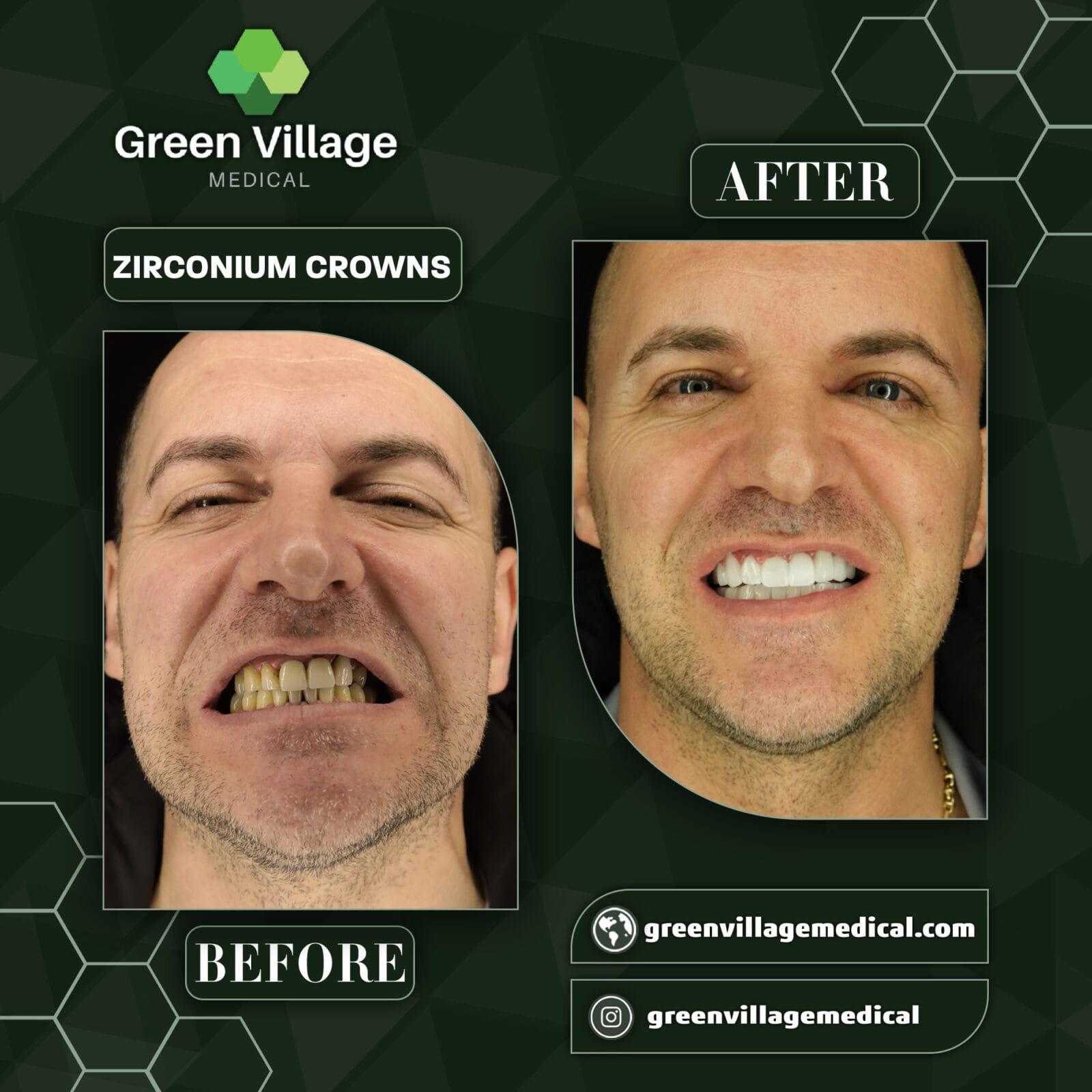 Digital Smile