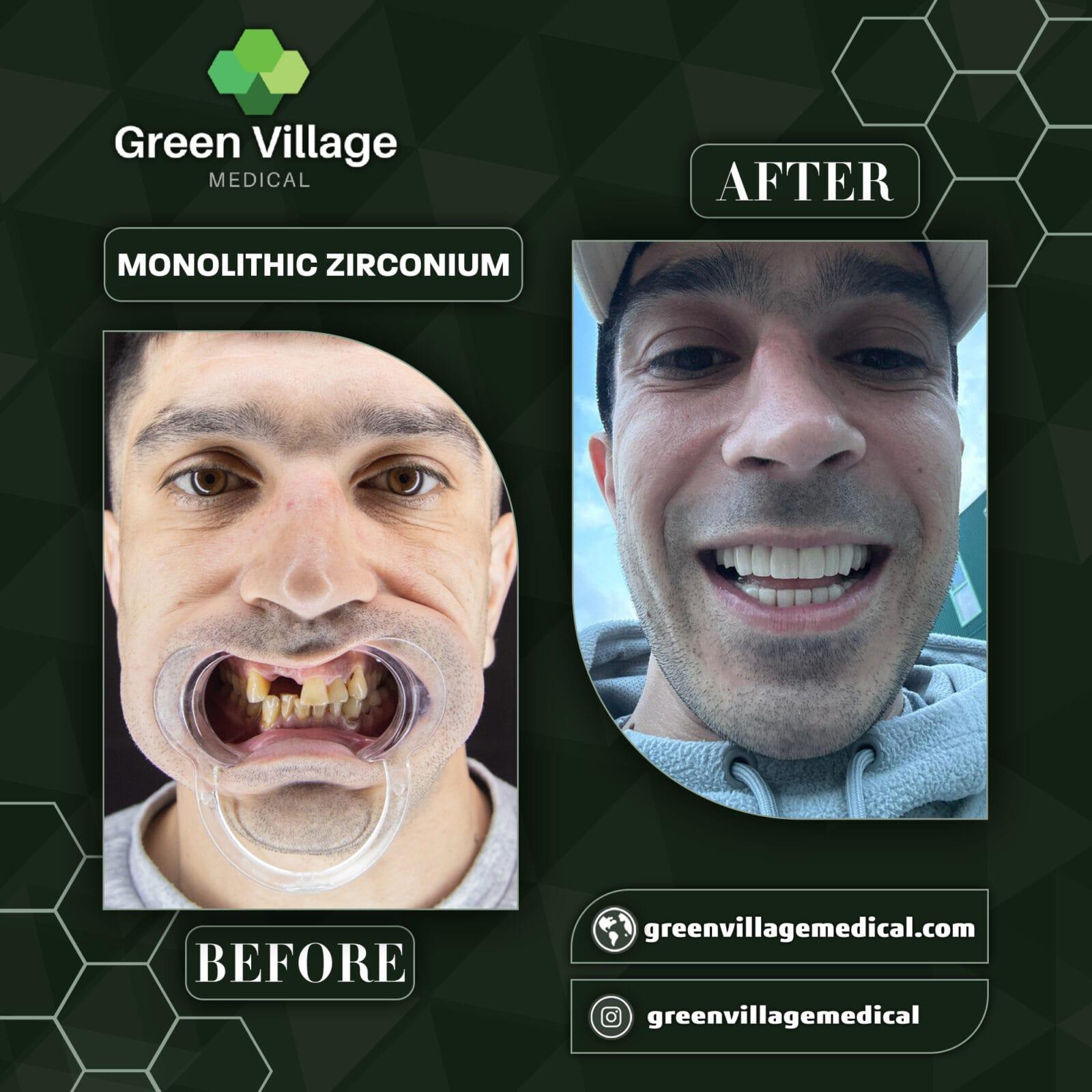 Digital Smile
