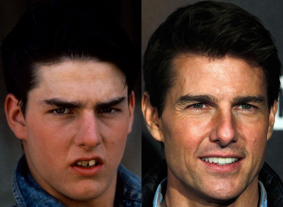 Tom Cruise